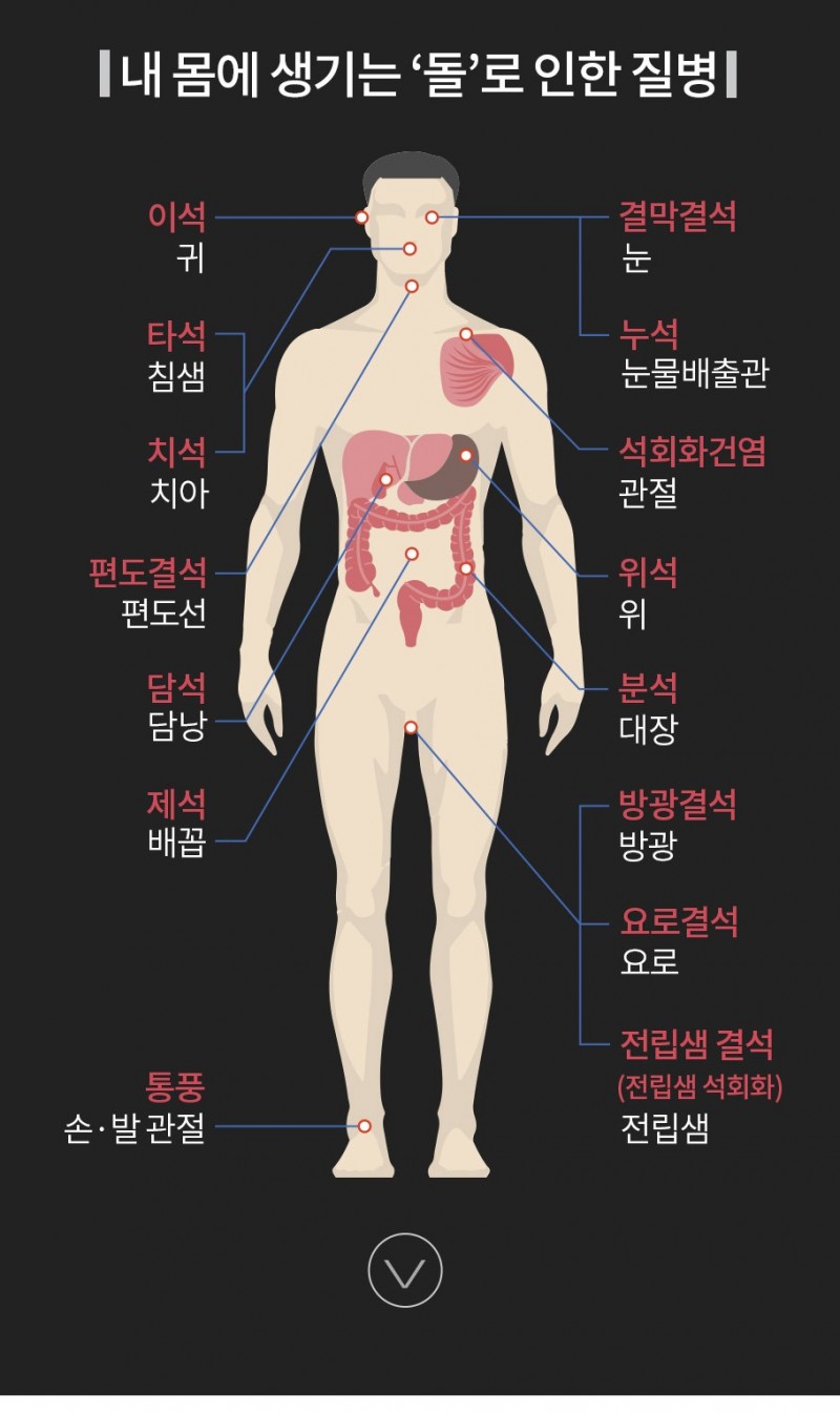 녹번 2구역-입냄새는 왜나는걸까.jpg-3번 이미지