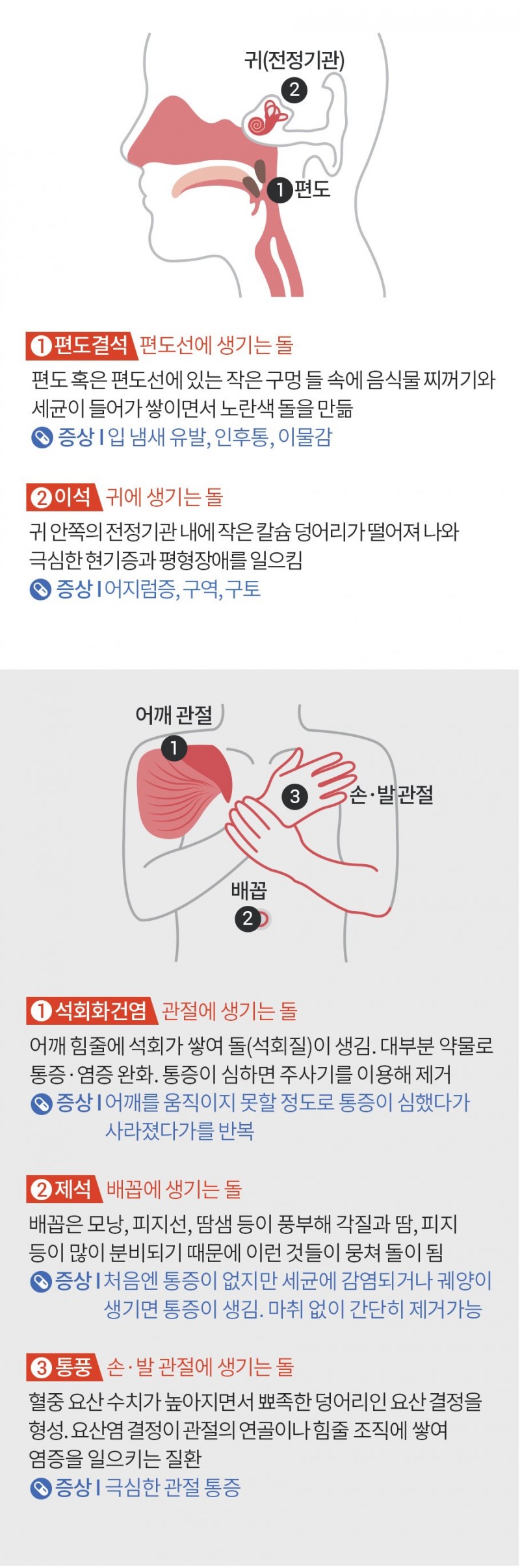 녹번 2구역-입냄새는 왜나는걸까.jpg-4번 이미지