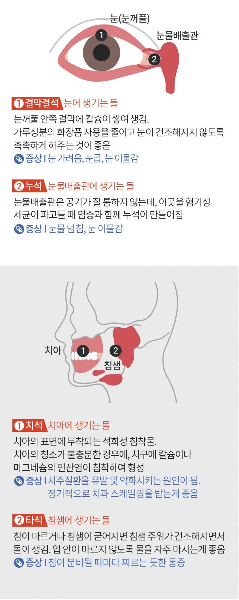 녹번 2구역-입냄새는 왜나는걸까.jpg-6번 이미지