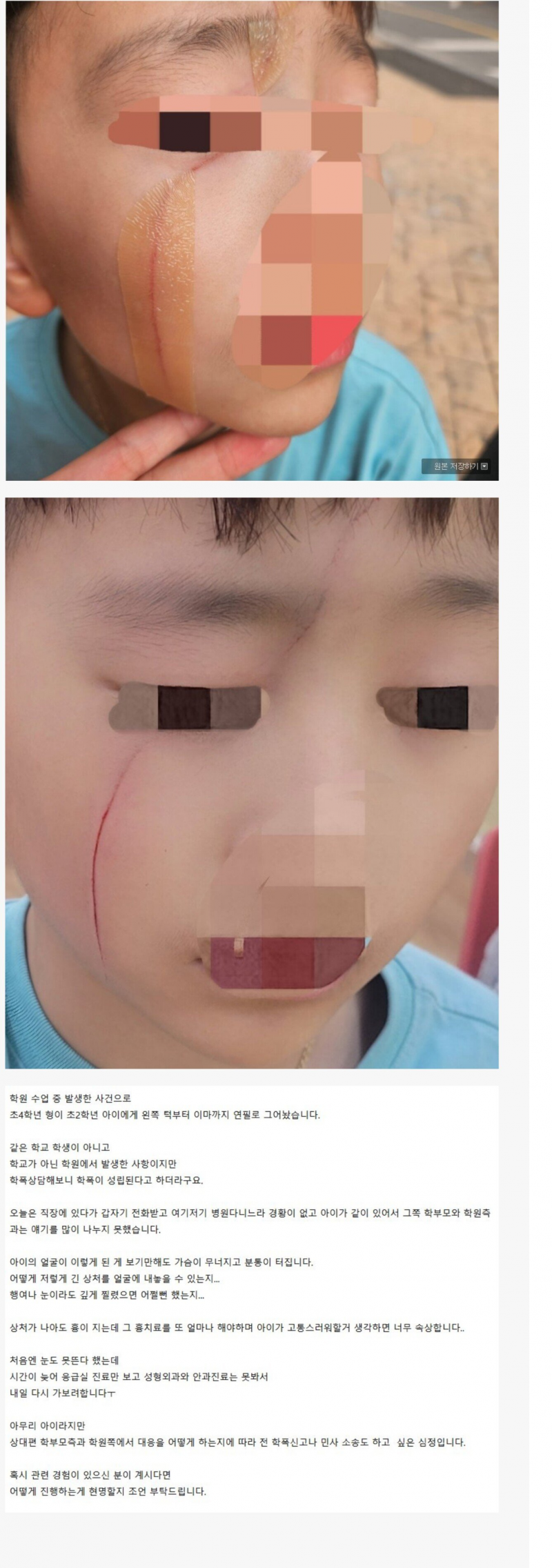 nokbeon.net-혐)초딩 4학년이 연필로 얼굴 그어놓음.jpg-1번 이미지