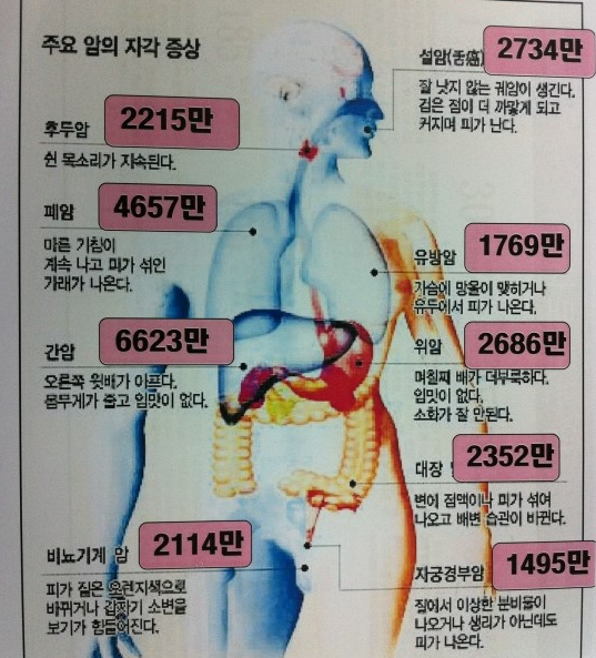 nokbeon.net-심근경색..즉 삼장마비를 바로 옆에서 본 경험.그리고암ㄷㄷ-2번 이미지