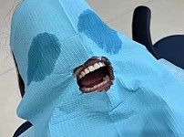 썸네일-"자 환자분 아프면 말하세요~".jpg-이미지